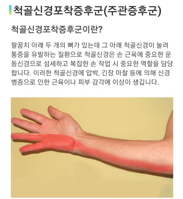 휴대폰 할 때 소지 손가락으로 받치는거 절대 하지마세요 | 인스티즈