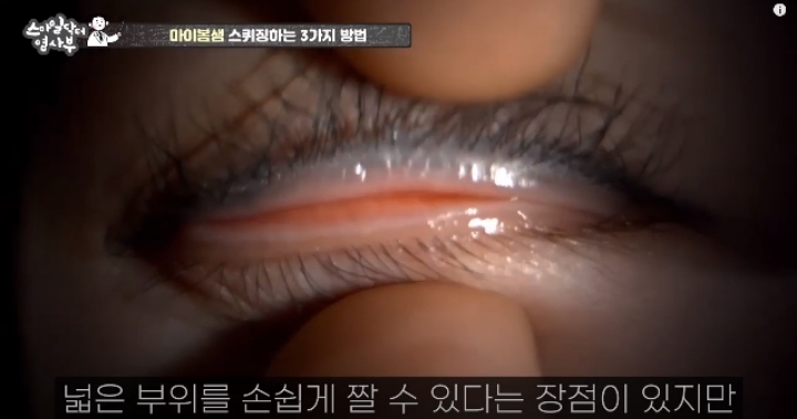 눈꺼풀에도 피지있는거 알아?? jpg (feat. 피르가즘) | 인스티즈