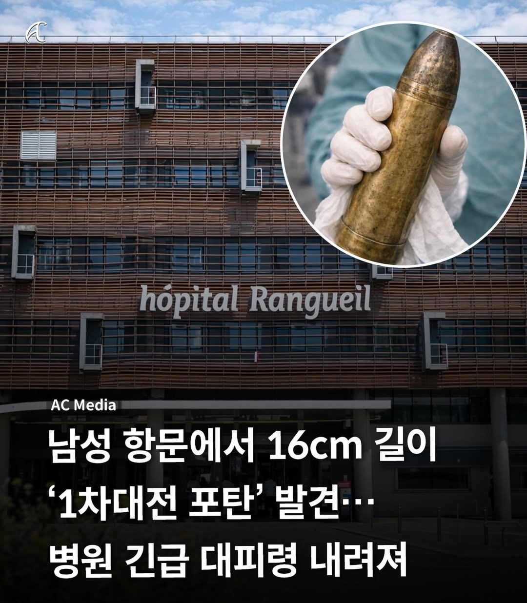 항문에서 발견된 포탄 실제 모습 | 인스티즈