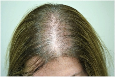 내기준 이거 빗겨가는 사람은 운 째지는 사람 | 인스티즈