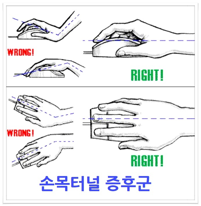 남자보다 여자가 더 잘걸리는 것 8가지 | 인스티즈