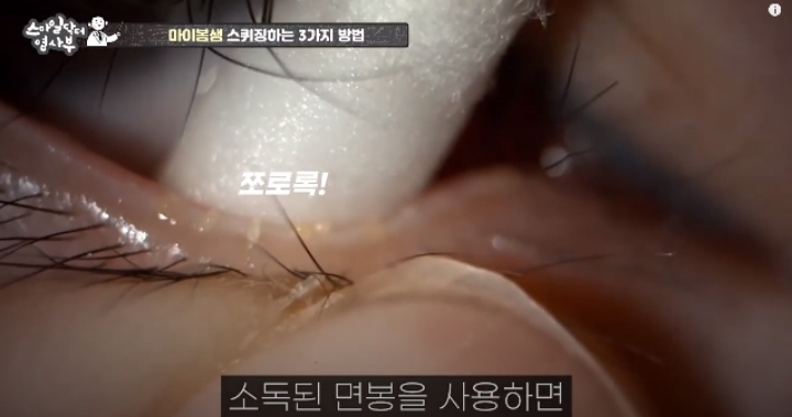 눈꺼풀에도 피지있는거 알아?? jpg (feat. 피르가즘) | 인스티즈