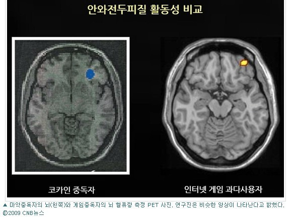 스마트폰 중독 5년 이상이면 난치병.jpg | 인스티즈