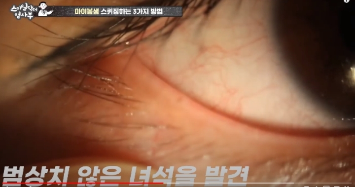 눈꺼풀에도 피지있는거 알아?? jpg (feat. 피르가즘) | 인스티즈