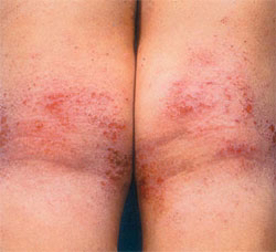 내기준 이거 빗겨가는 사람은 운 째지는 사람 | 인스티즈