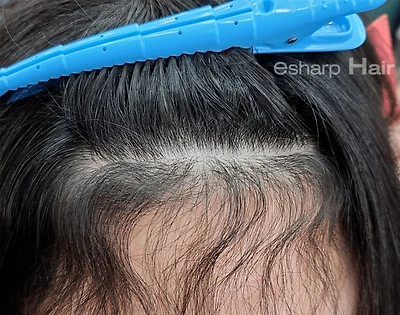 이런 곱슬 가진 사람 은근 있음 | 인스티즈