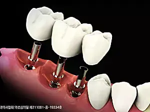물방울치과의원 이미지
