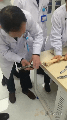 (혐오주의) 정형외과 의사가 힘이 좋아야 하는 이유.gif | 인스티즈