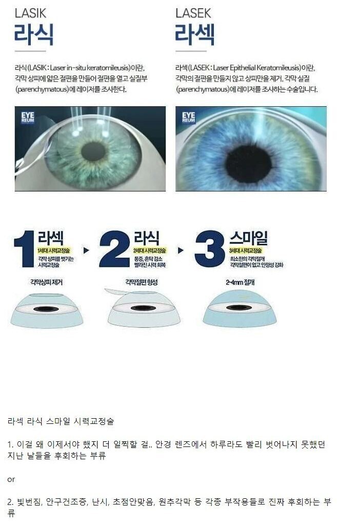 하고나서 대부분 후회한다는 수술 | 인스티즈