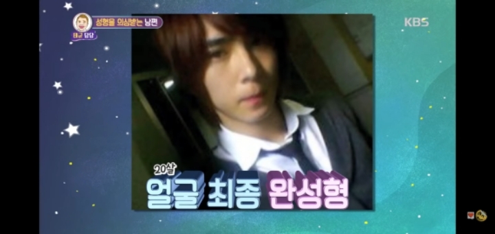 성형 햔곳도 안했는데 성형했다는 오해 받았던 예능 일반인 출연자 | 인스티즈