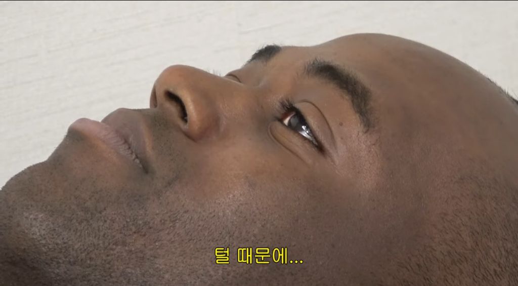 생각지도못한 조나단이 레이저 제모 못하는 이유 | 인스티즈