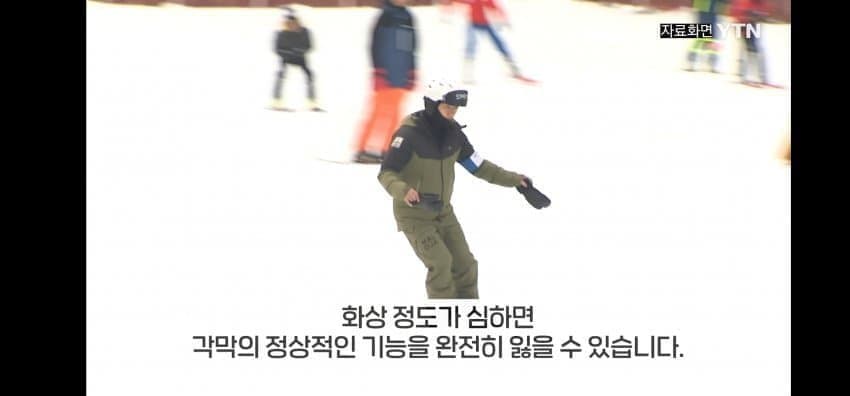 다들 겨울철 각막화상 조심하세요 | 인스티즈