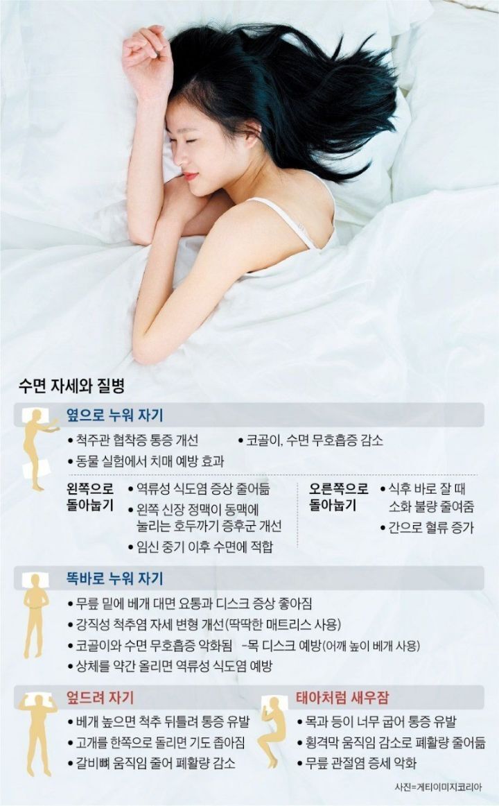 수면자세 안좋을때 생기는 병.JPG | 인스티즈