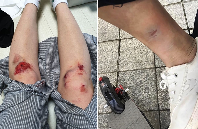 공유 전동킥보드의 치명적 허점 | 인스티즈