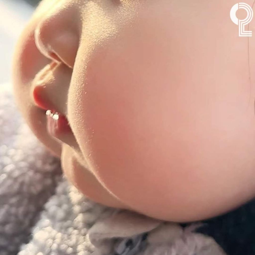 아기 볼살 | 인스티즈