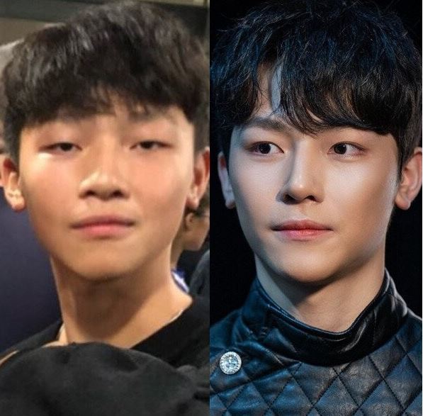 성형이 사기인 이유 | 인스티즈