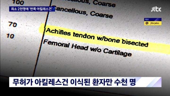 지난 7년간 십자인대 수술 받은 사람 중 무허가 인대 이식 받은 사람 최소 2천명 | 인스티즈