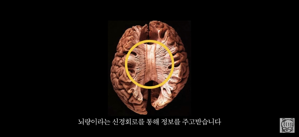 (스압)분리 뇌 실험 | 인스티즈