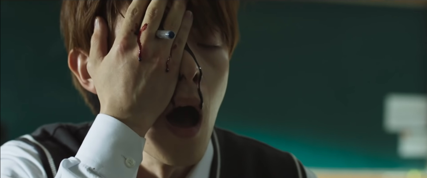 볼펜으로 일진 눈을 찔러버렸어요.... | 인스티즈