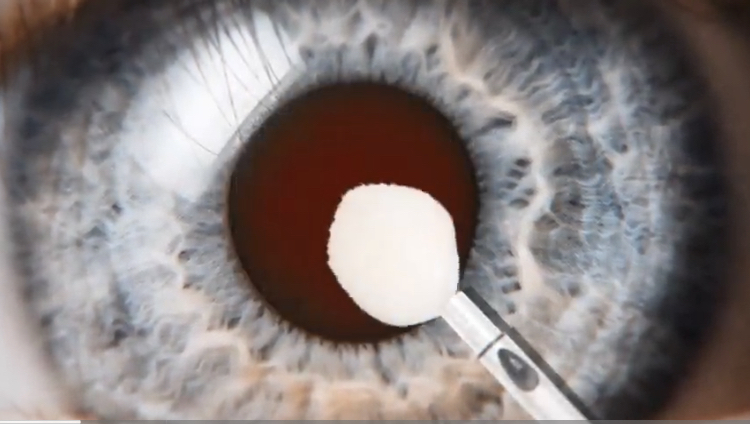 전세계 유튜브 구독자 1위 미스터 비스트 근황 | 인스티즈