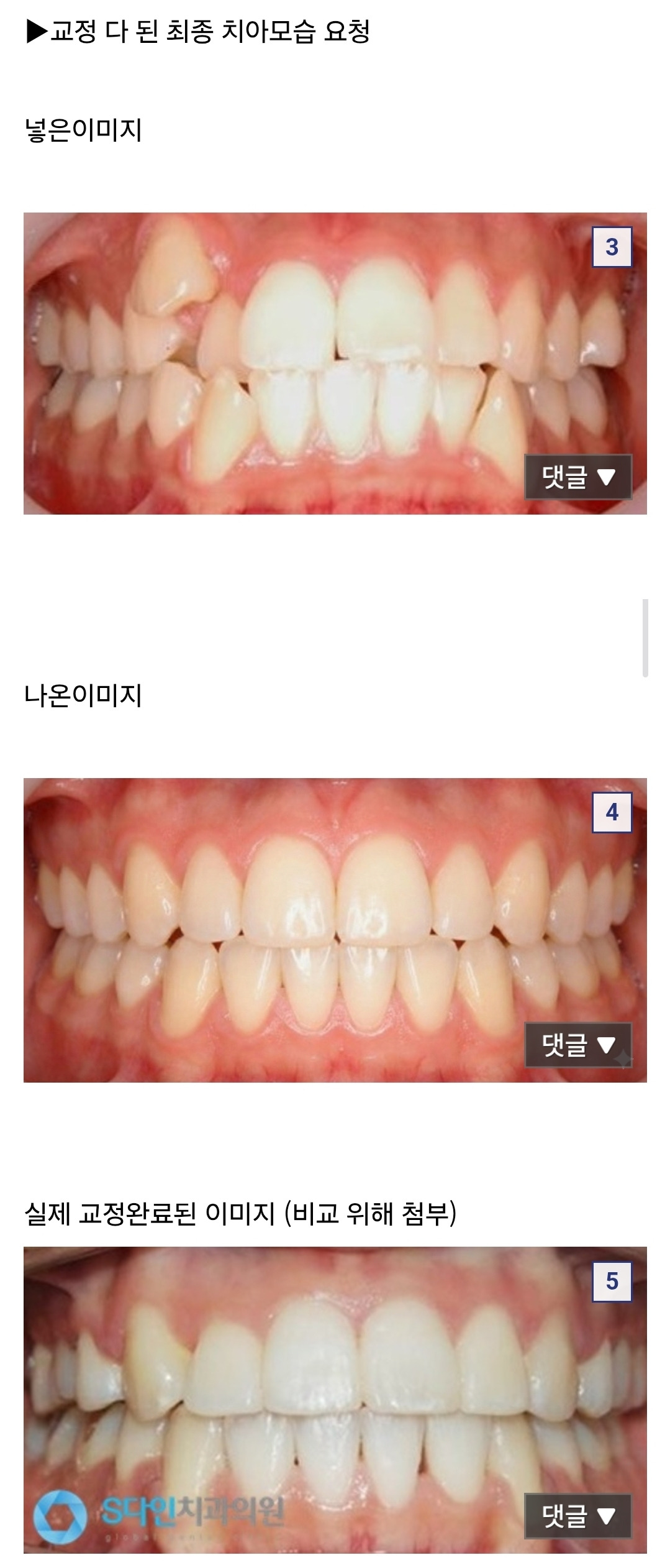 AI 나노바나나2로 만든 이미지들 | 인스티즈