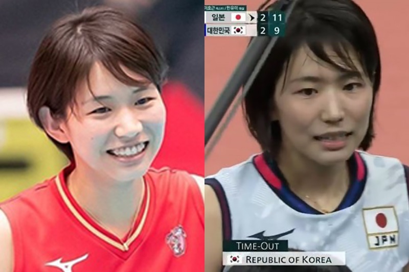 여자들이 치아교정 하는이유 | 인스티즈