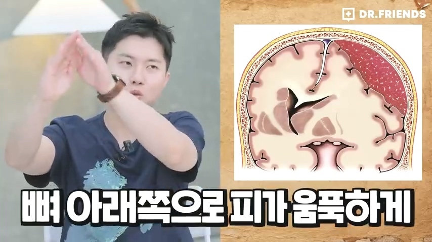 과거 사람들이 두통 생기면 뚝배기부터 열었던 이유 | 인스티즈