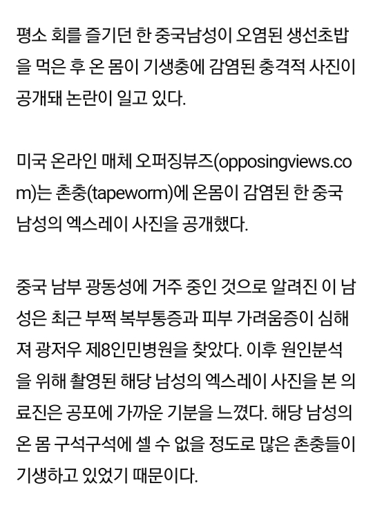 (혐오주의) 생선회 먹고 기생충이 온몸에 퍼진 남성 | 인스티즈