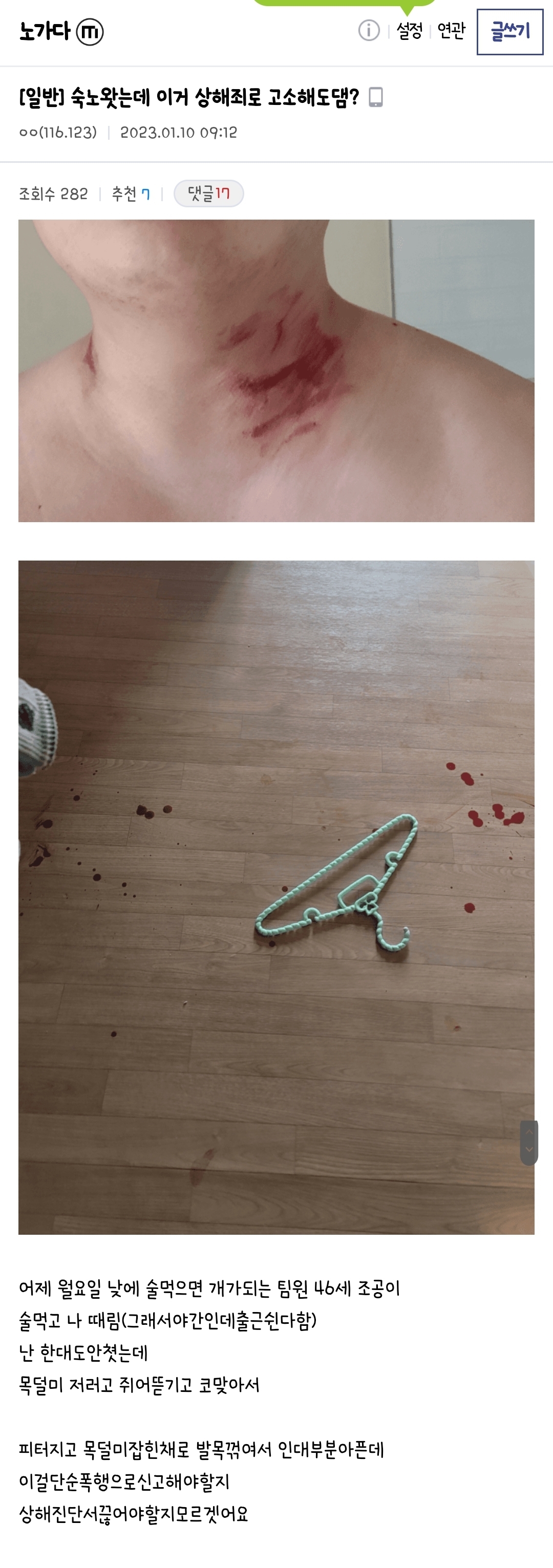 (혐오주의) 오늘자 노가다 숙소에서 폭행당한 디시인 | 인스티즈