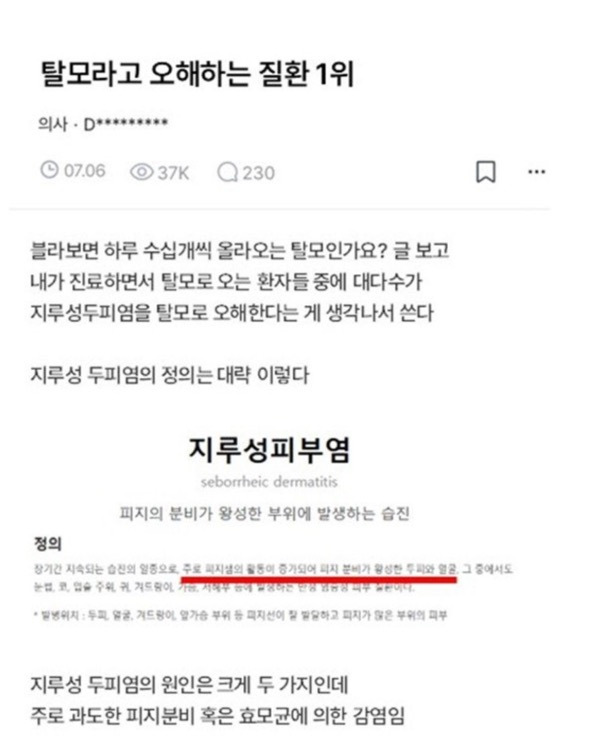 탈모라고 오해하는 질환 1위 | 인스티즈