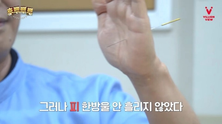 어릴 때 한번 쯤 해본 바늘로 손 뚫기 | 인스티즈