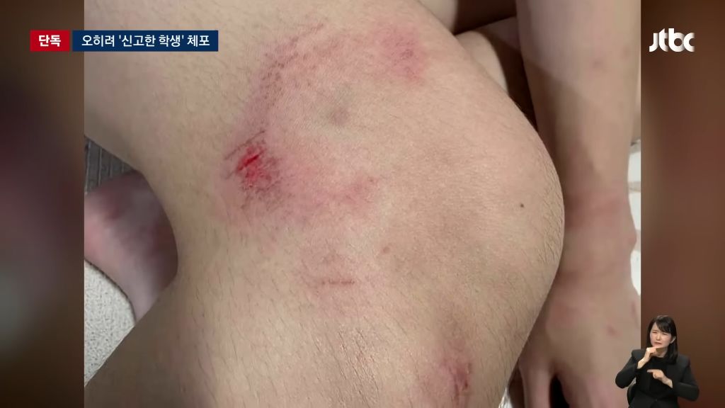 신고한 학생을 헤드록으로 제압해 체포한 경찰 | 인스티즈