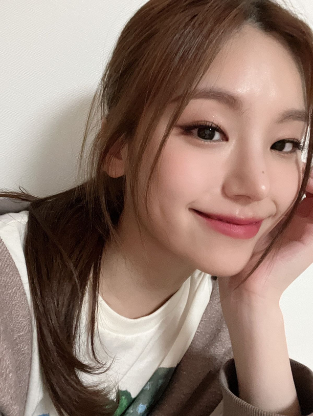 자고 일어났더니 한쪽 쌍커풀이 커졌다는 ITZY예지 | 인스티즈