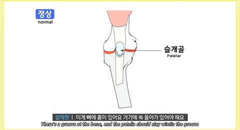 국내 소형견이 유독 슬개골 탈구가 많은 이유 | 인스티즈