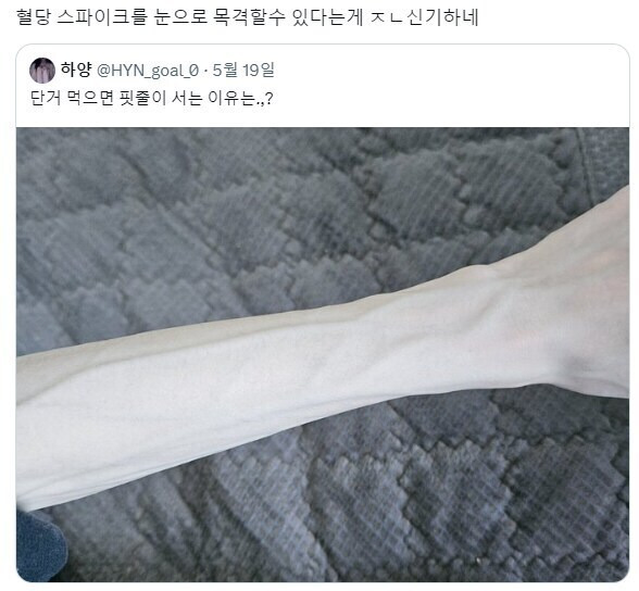 혈당 스파이크 체감하기 .jpg | 인스티즈