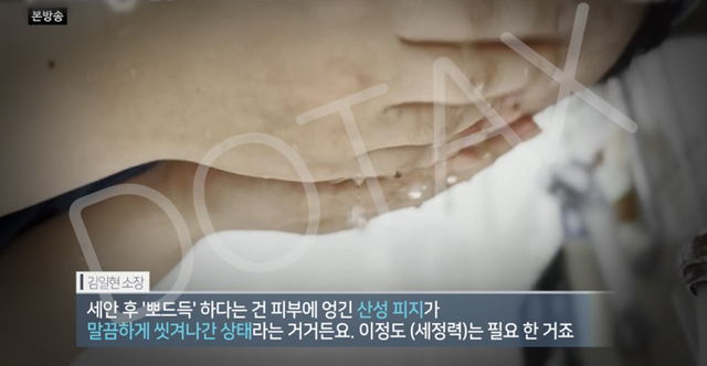 얼굴에 뭉치는 여드름 '산성피지'의 진실.jpg | 인스티즈