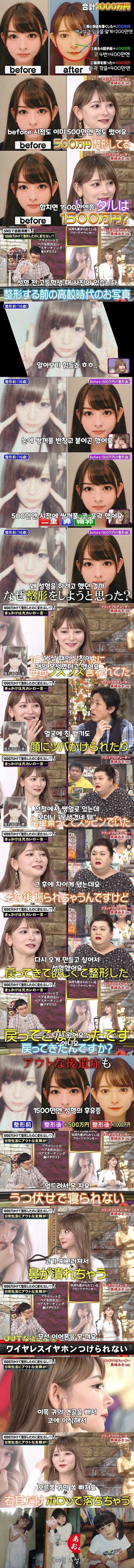 성형수술에 1500만엔 쓴 일본 여자 | 인스티즈