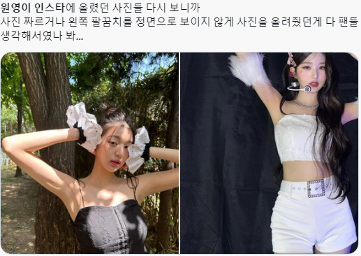 아이브 I AM 뮤비 찍다가 응급실가서 7바늘 꿰맸던 장원영.jpg | 인스티즈