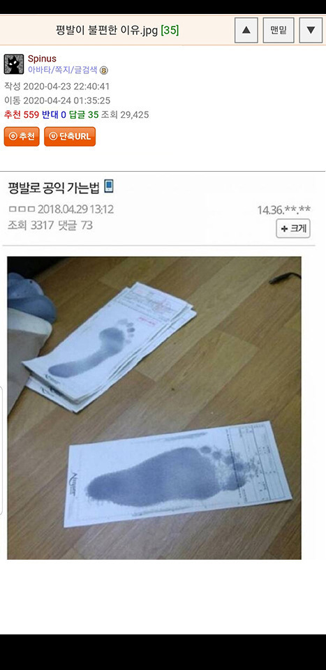 평발이 불편한 이유 | 인스티즈
