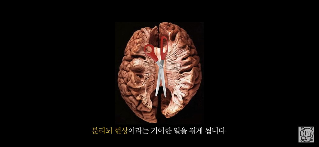 (스압)분리 뇌 실험 | 인스티즈