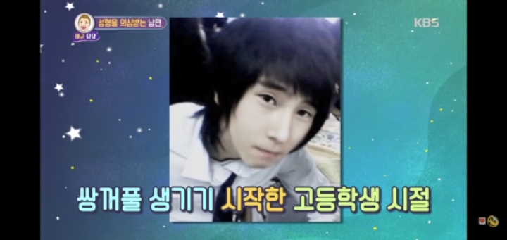 성형 햔곳도 안했는데 성형했다는 오해 받았던 예능 일반인 출연자 | 인스티즈