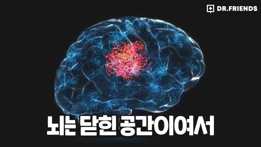 과거 사람들이 두통 생기면 뚝배기부터 열었던 이유 | 인스티즈