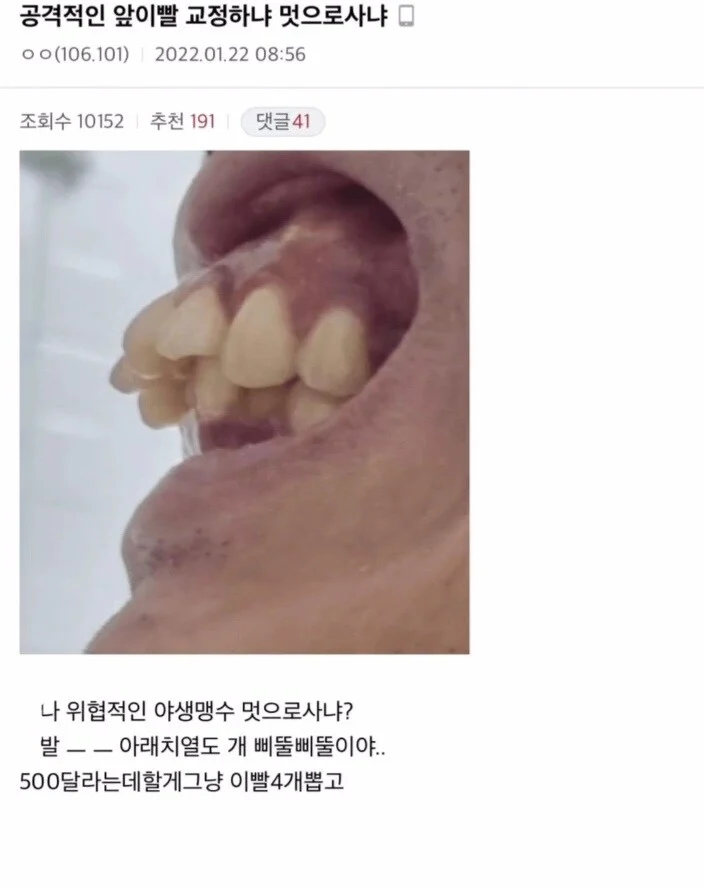 교정갤에 나타난 역대급 사례 | 인스티즈