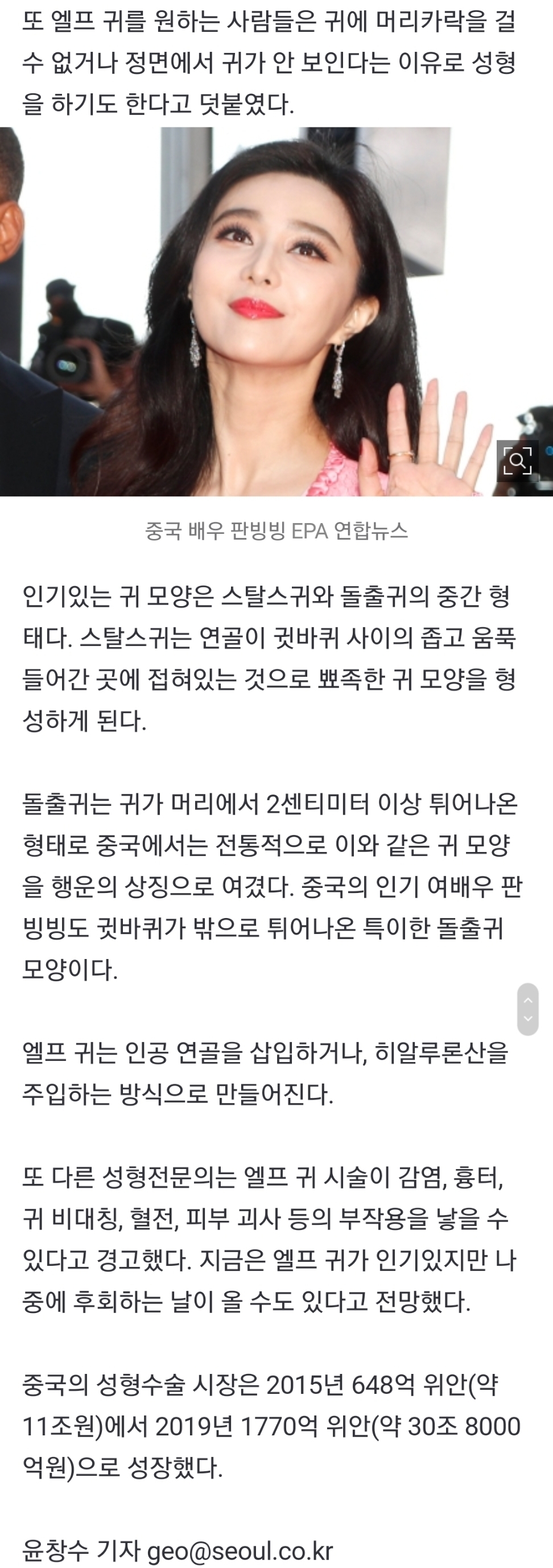 중국 젊은층 얼굴 작아보인단 이유로 '엘프 귀' 성형 인기 | 인스티즈