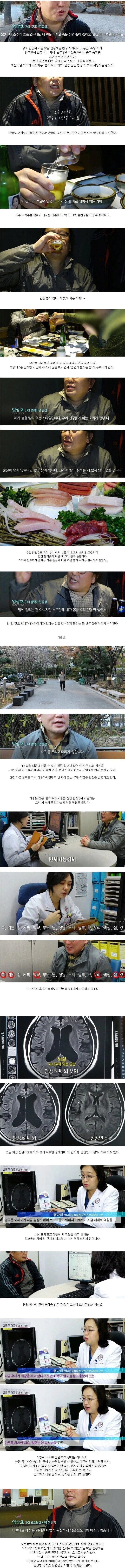50대 애주가의 뇌상태 | 인스티즈