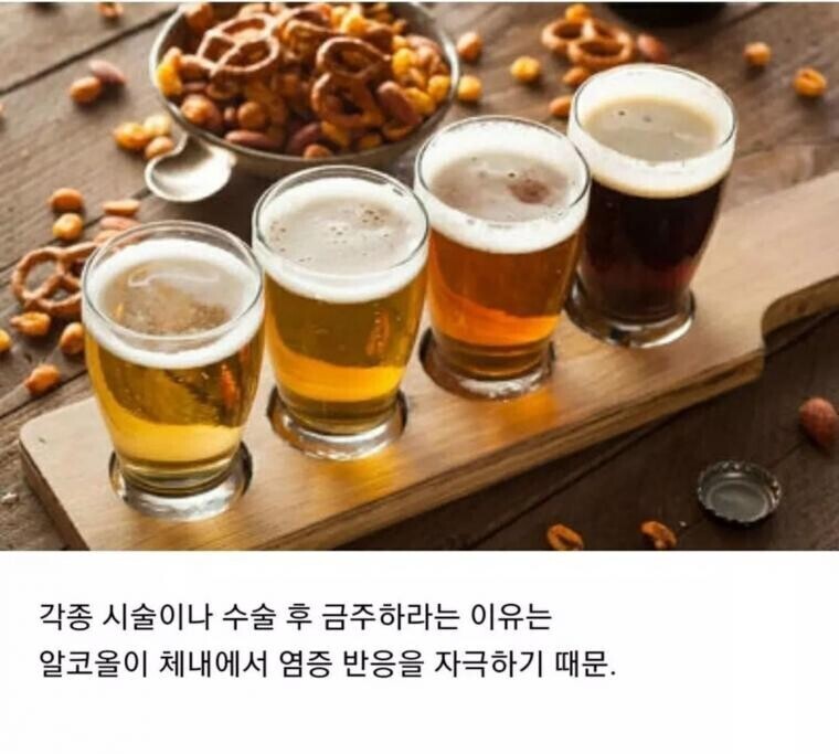 의사들은 거른다는 음식.jpg | 인스티즈