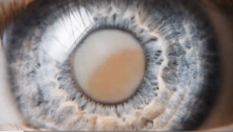 전세계 유튜브 구독자 1위 미스터 비스트 근황 | 인스티즈