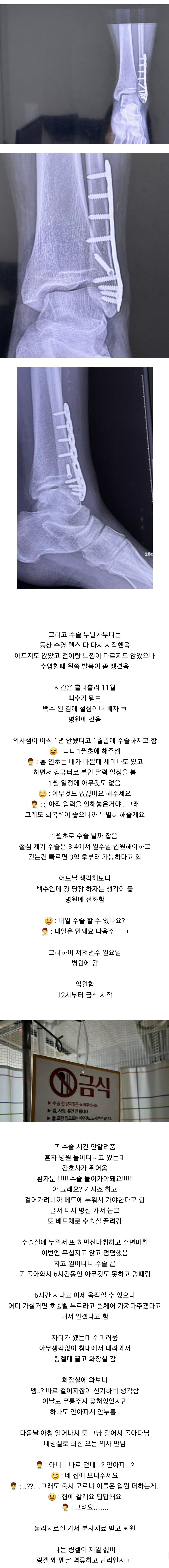 약혐주의) 어느 건강하고 회복력 아주 좋은 쾌녀의 발목뼈 부러진 후기 | 인스티즈