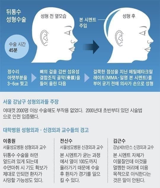 요즘 몇몇 강남 성형외과에서 많이 하는 수술.jpg | 인스티즈