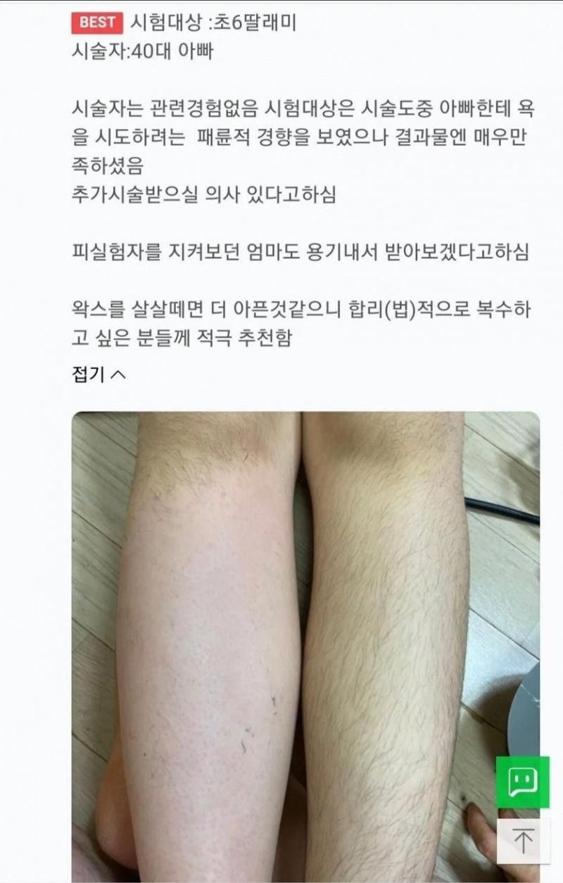 초 6딸을 왁싱한 40대 아빠 | 인스티즈